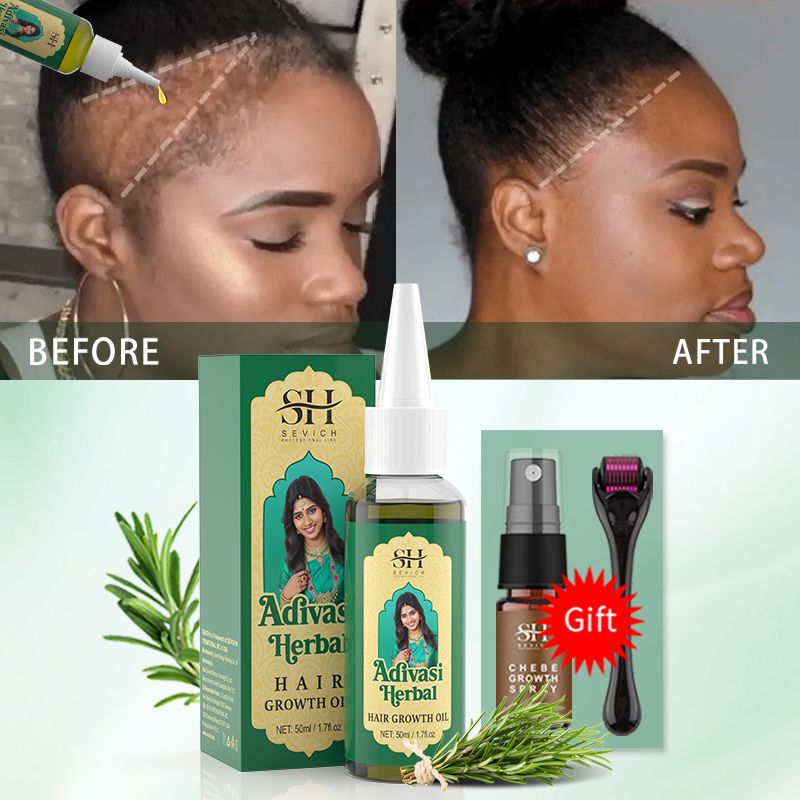 Minyak Pertumbuhan Rambut Ayur - Hair Care Essence Oil Spray ulasan dan harga