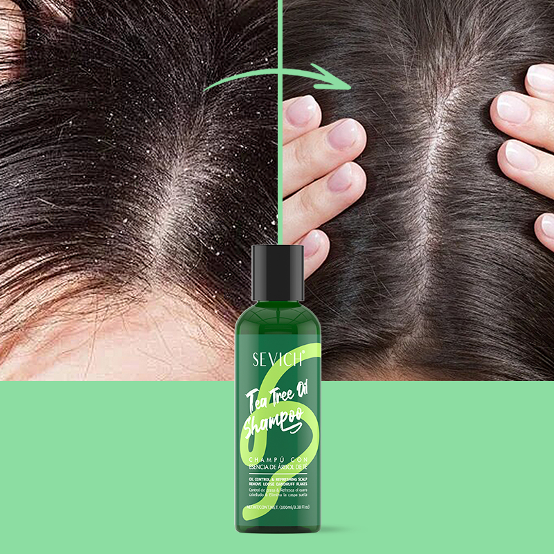 Set Kondisioner Rambut Sampo E - Hair Care Essence ulasan dan harga