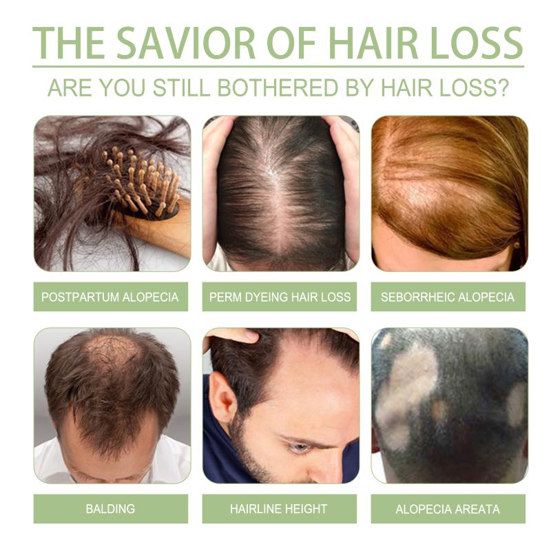 Minyak Penumbuh Rambut Baru 10 - Hair Care India ulasan dan harga