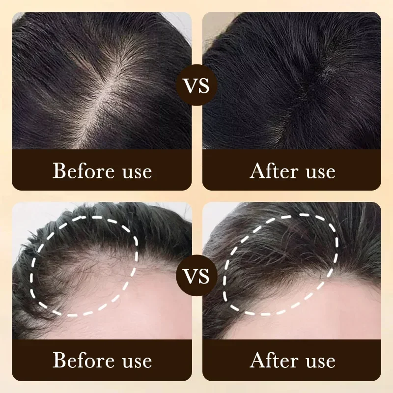 Produk Minyak Penumbuh Rambut  - Hair Care Essence Oil Spray ulasan dan harga