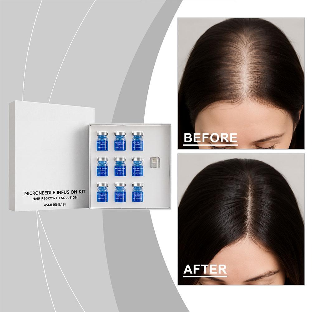 Set Rol Jarum Mikro Serum Esen - Hair Care Routine ulasan dan harga