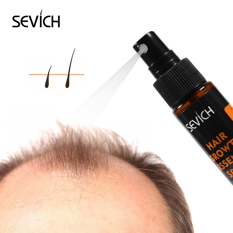 Sevich 30Ml Esensi Minyak Heba - Hair Care Essence Oil Spray ulasan dan harga