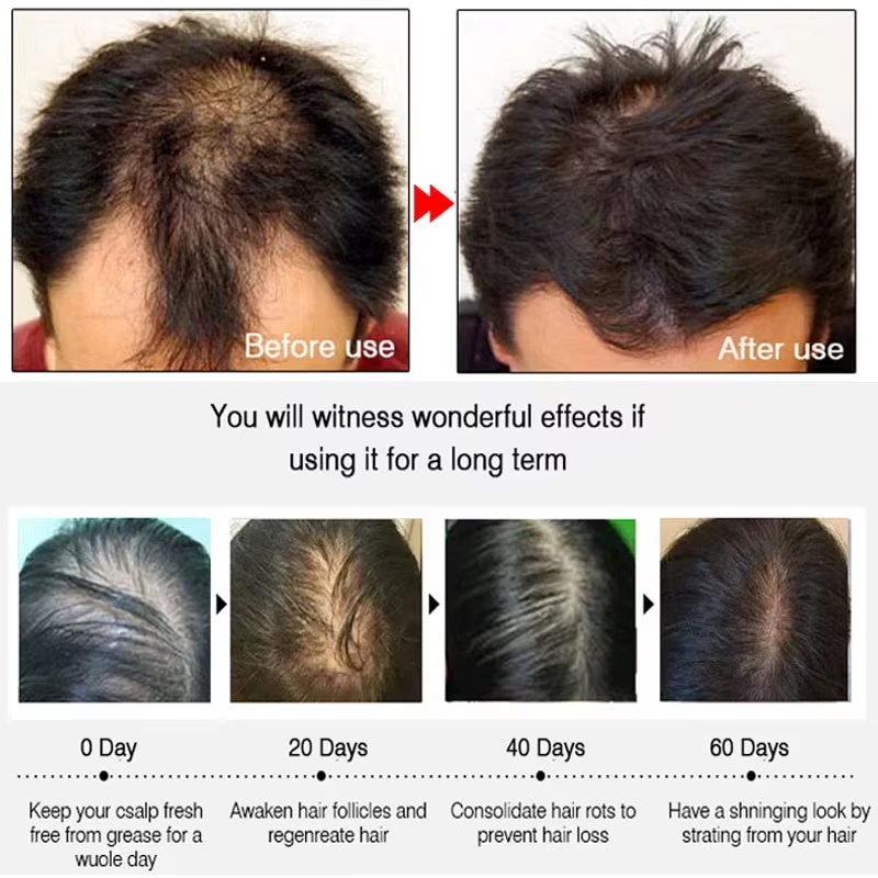 Semprotan Penumbuh Rambut Jahe - Hair Growth Serum Oil ulasan dan harga