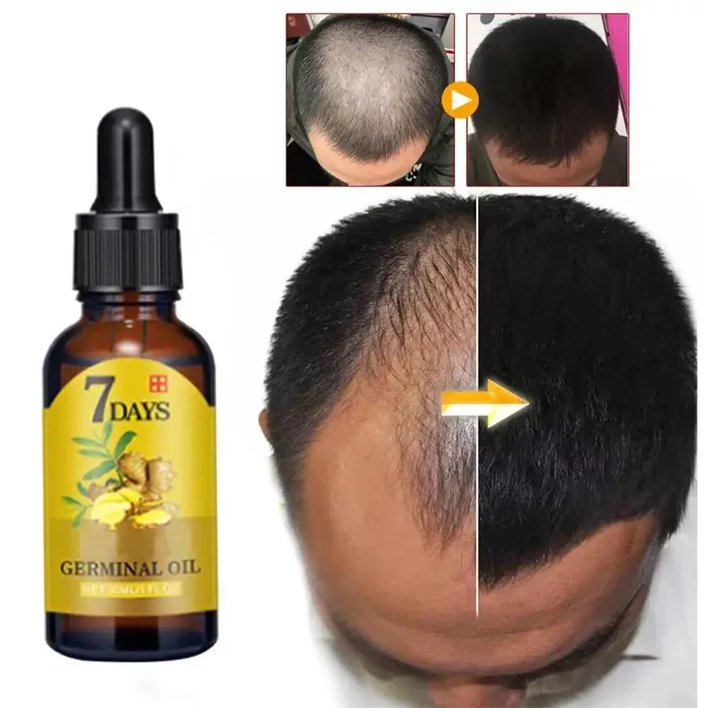 Minyak esensial penumbuh rambu - Hair Care Essence Oil Spray ulasan dan harga