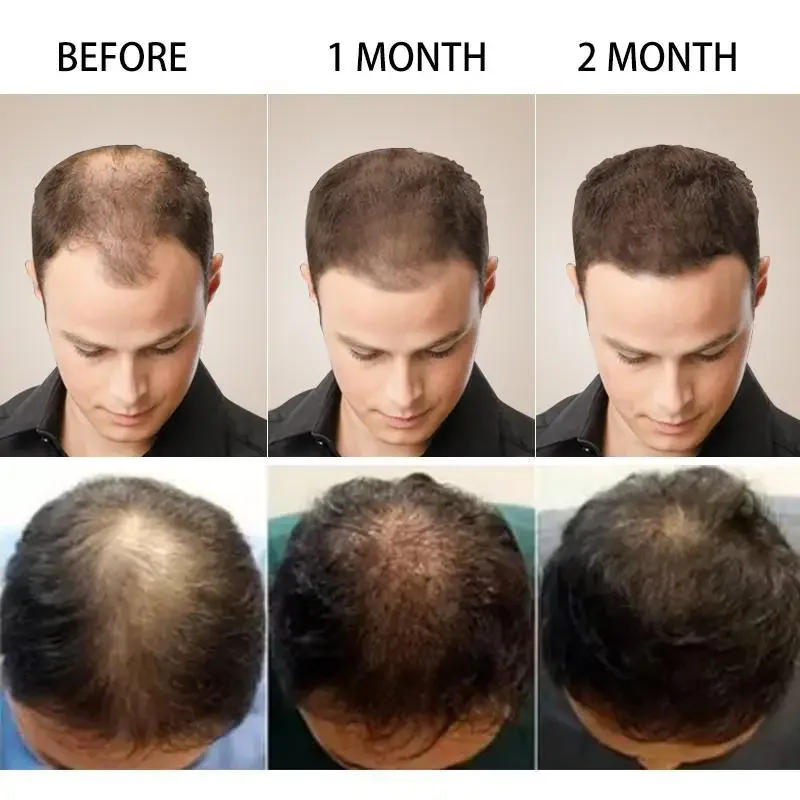 Minyak esensial penumbuh rambu - Hair Care Essence Oil Spray ulasan dan harga