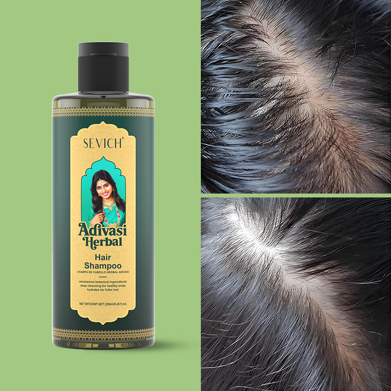 Set Minyak Penumbuh Rambut Ros - Hair Care India ulasan dan harga